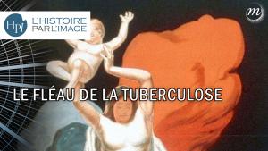 Le fléau de la tuberculose_miniature